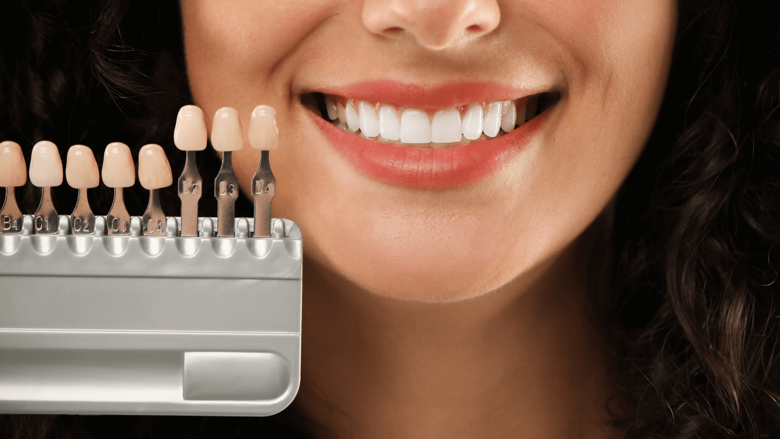5 Best Veneer Patient Appointment Software for a Dental Office